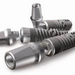 Dental_Implant.35333407_std (1)