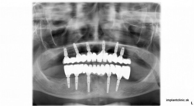 Erdelyiova_Iveta_29012014_110131