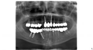 Snímok po ošetrení