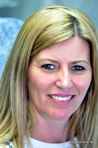 Pavla po nasadení mostíka