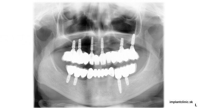 Hopkins_Wendy_03102013_175111