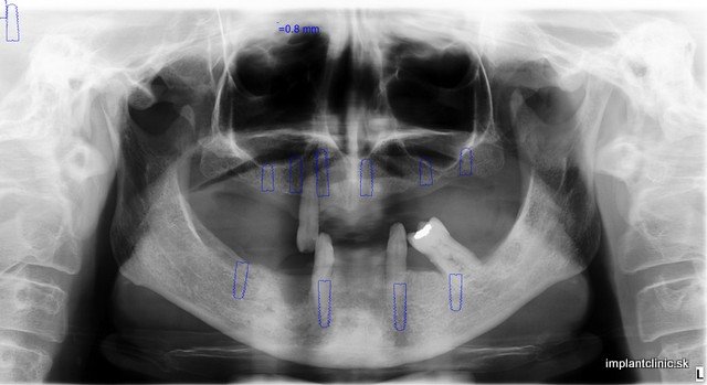 Hopkins_Wendy_19102011_103026