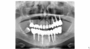 Alldridge_Gloria_12062014_132827