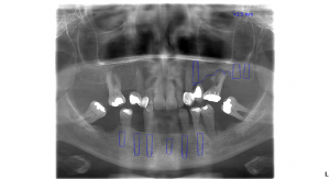 Alldridge_Gloria_17042013_084111 (1)